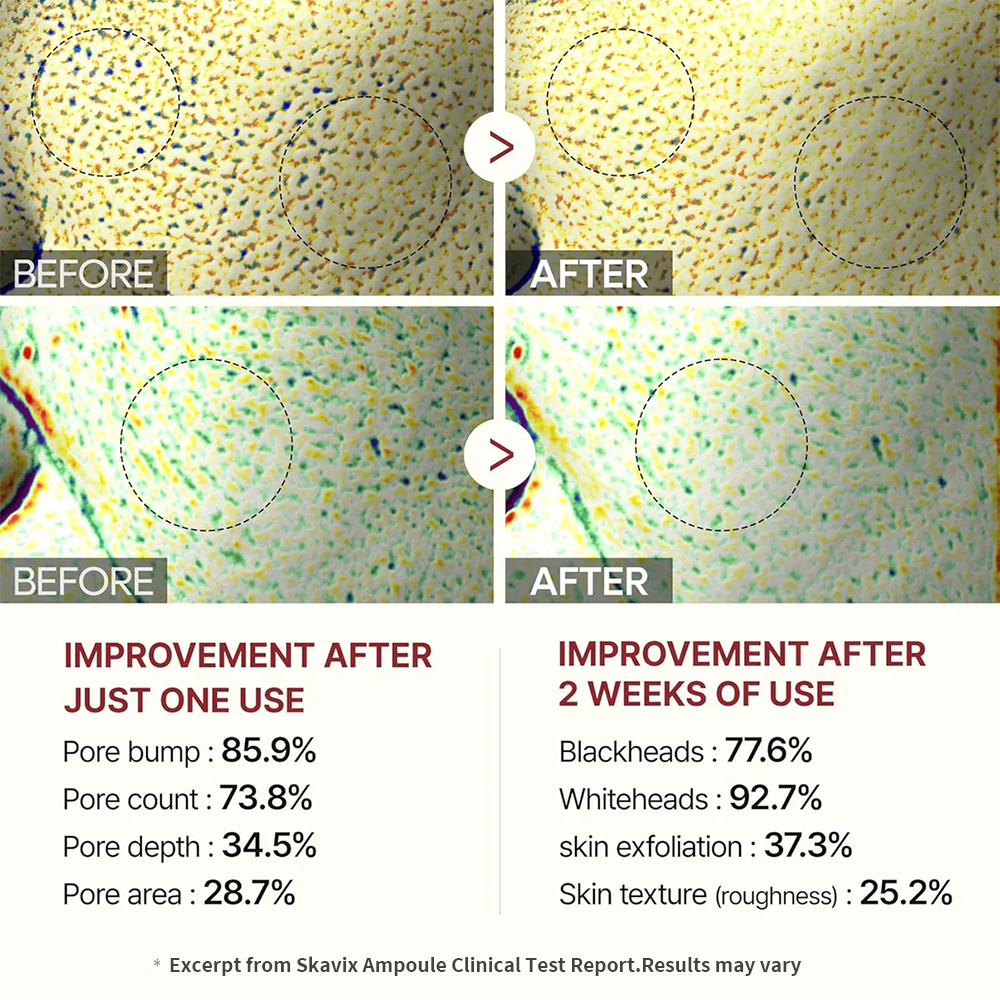 🏆فروش ویژه⚡ بیش از ۵۰ هزار عدد فروخته شد! تقریباً تمام شد-💥🔥سرم روشن کننده و مرطوب کننده ارتقا یافته Skavix™